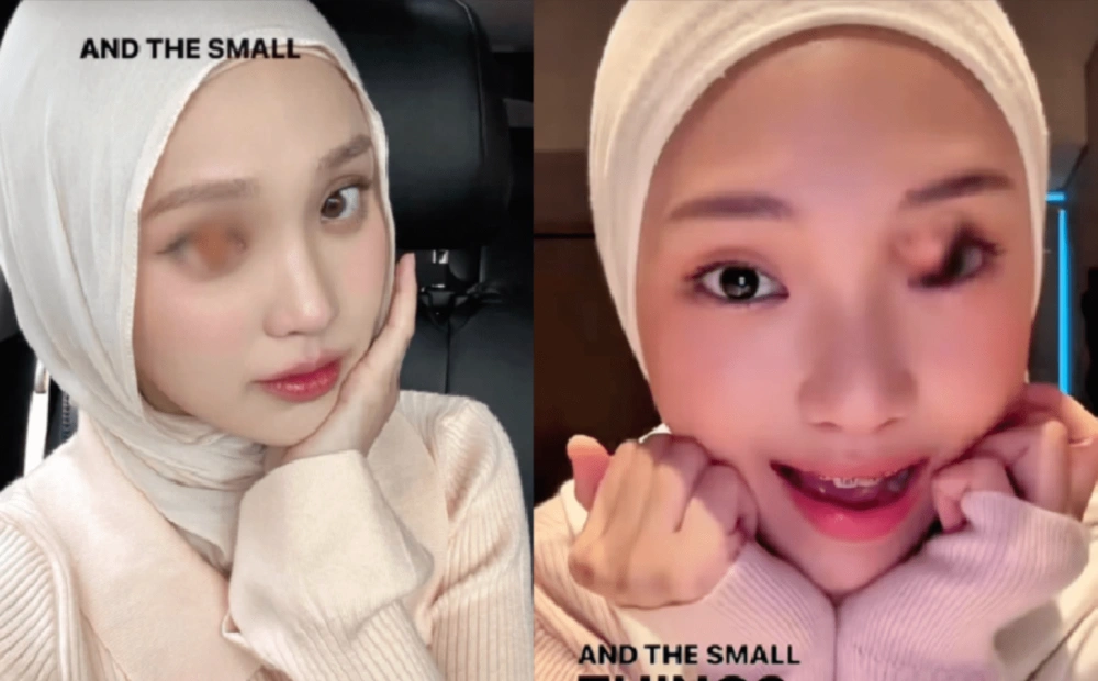 Link Jule dan Yuka Zoom Mata Full. [TikTok]