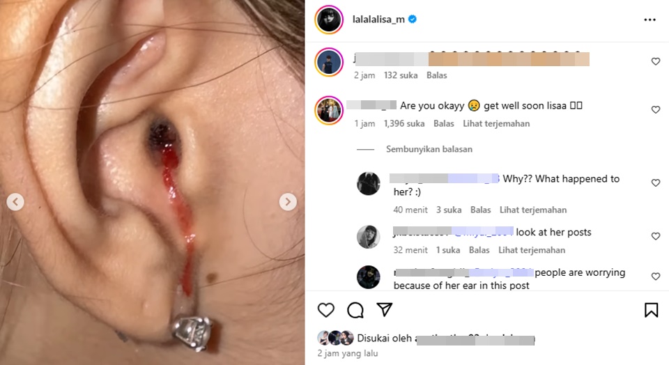 Lisa BLACKPINK Bagikan Video Telinga Berdarah Bikin Khawatir [Instagram]