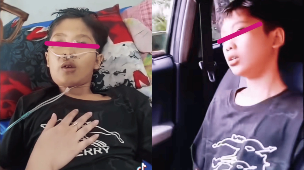 Nizam Syafei Korban Penganiayaan Ibu Tiri [Sumber: Tiktok]