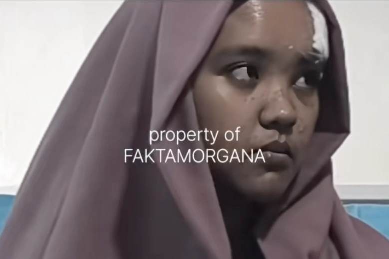 Penampilan terbaru Fara usai pulih dari cedera parah dalam pembacokan oleh Reyhan. [TIkTok/Faktamorgana]