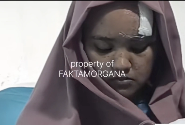 Penampilan terbaru Fara usai pulih dari cedera parah dalam pembacokan oleh Reyhan. [TIkTok/Faktamorgana]