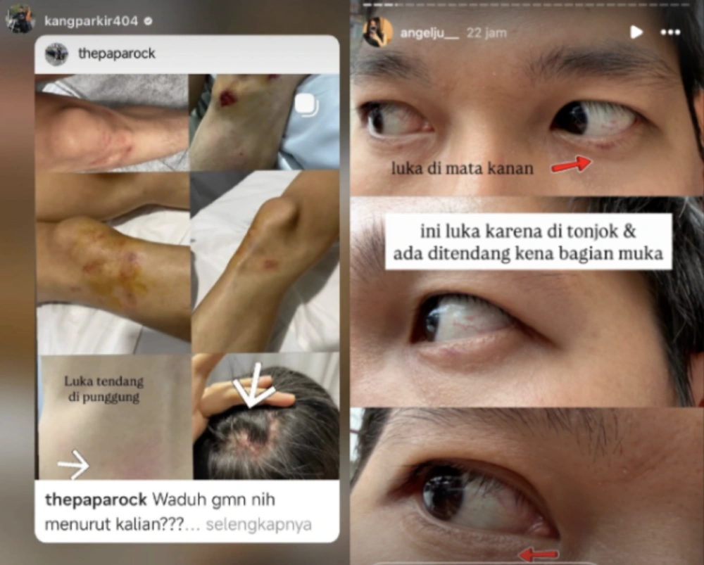Penganiayaan terhadap Darwin warga Cengkareng oleh Dodo BT. [Instagram/Angel J]