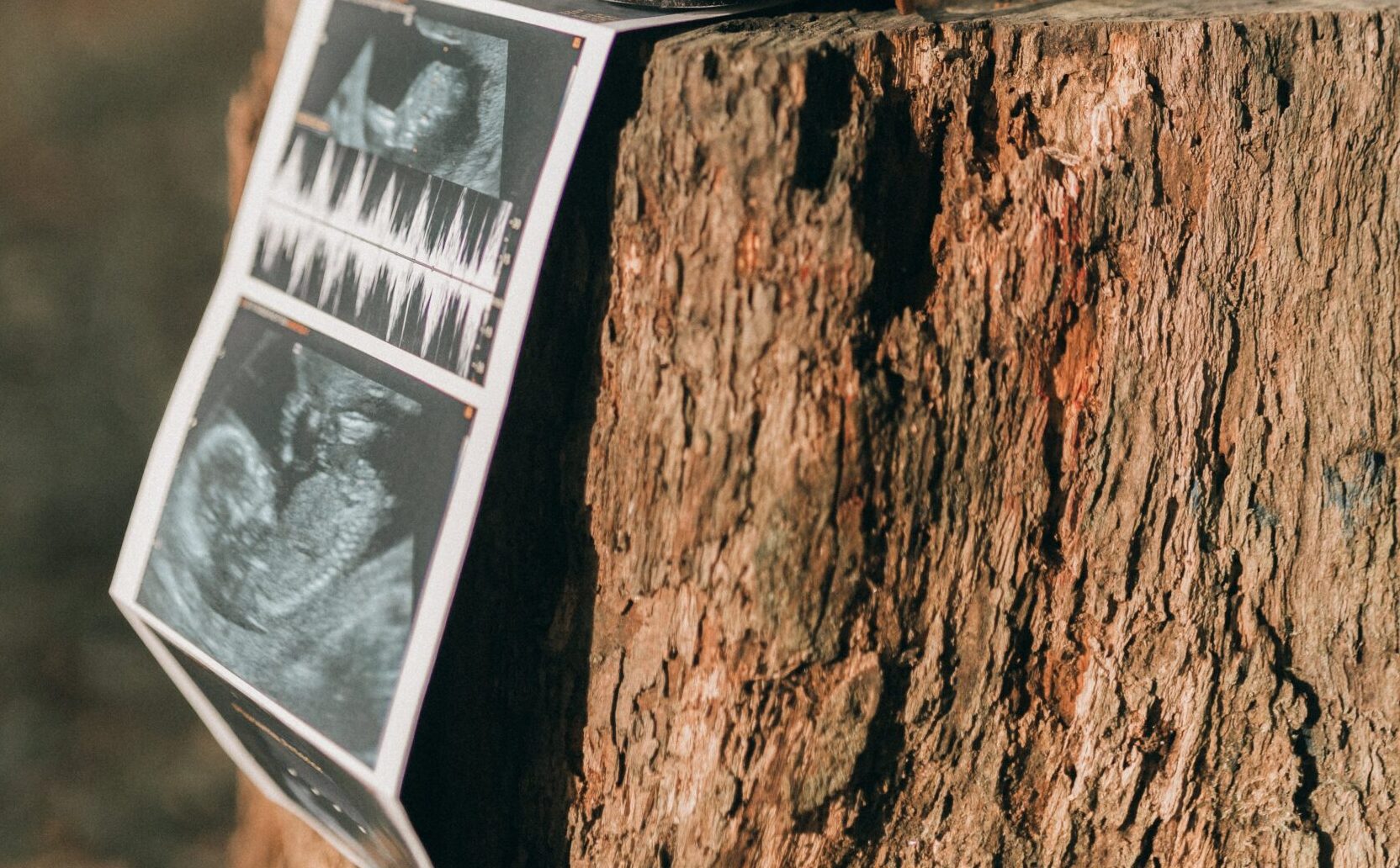 Peneliti Ini Ungkap Jika Janin Bisa Merespon Makanan yang Dikonsumsi Ibu Selama Kehamilan