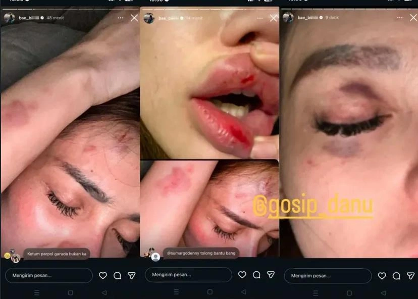 Potret Nabilla Yang Pernah Dianiaya Mantan Pasangannya Instagram