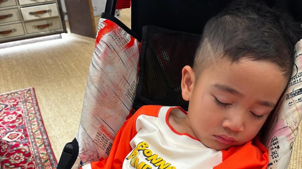 Raffi Ahmad Tunjukkan Wajah Luka Rayyanza Usai Digigit Lily [Instagram]