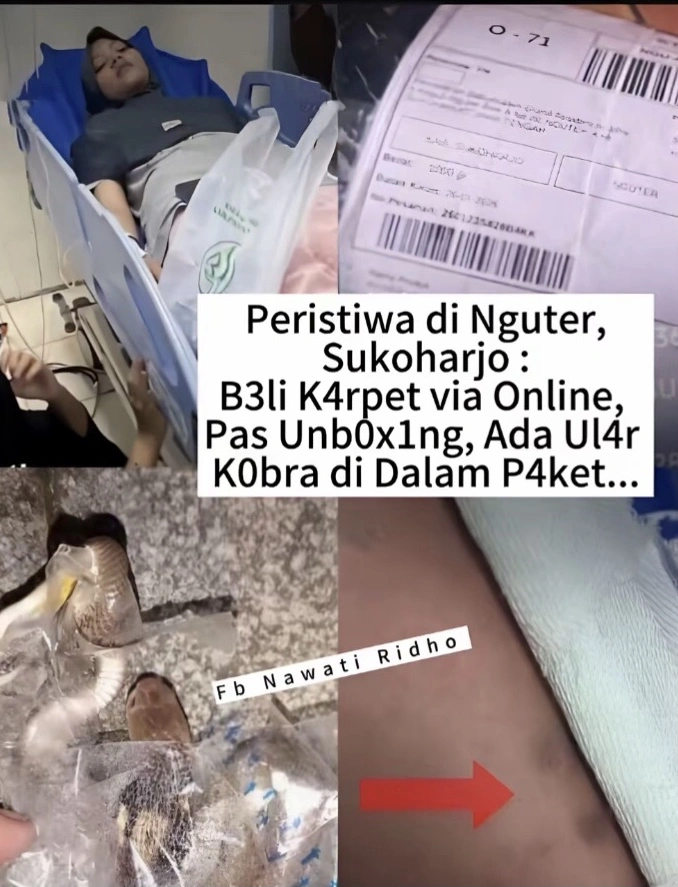 Remaja Perempuan Yang Digigit Anak Ular Kobra Di Dalam Paket [Tiktok]