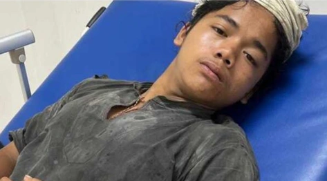 Repan Dari Baduy Jadi Korban Begal Instagram