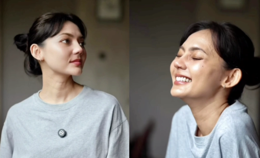 Hasil Operasi Plastik Rina Nose. [Instagram/dr Tompi]