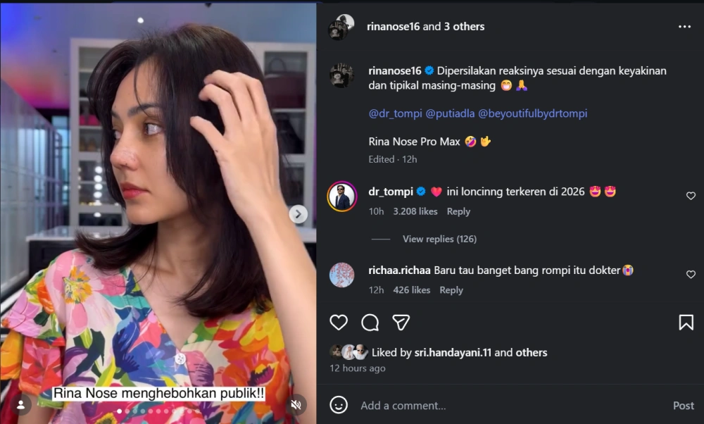 Rina Nose Ungkap Alasan Oplas [Sumber: Instagram]