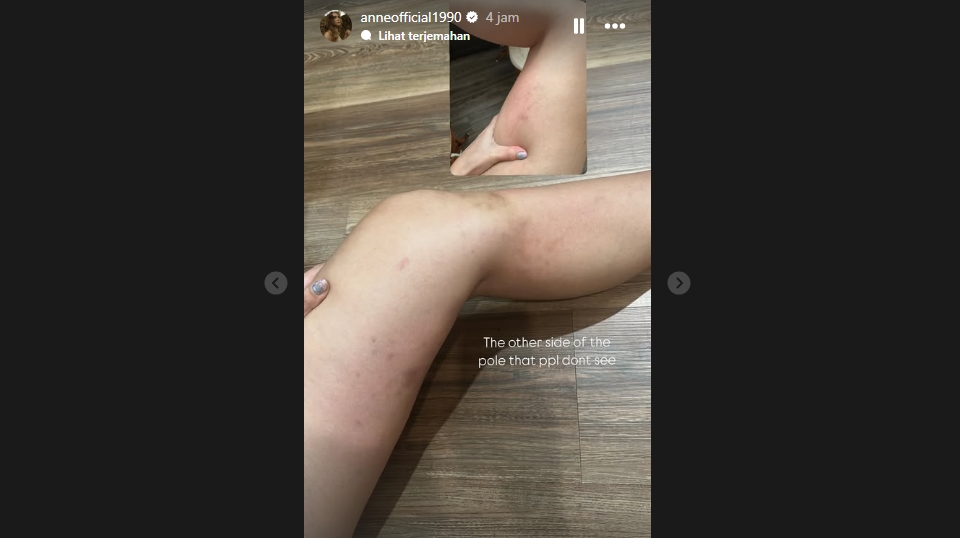 Instagram Story Putri Anne