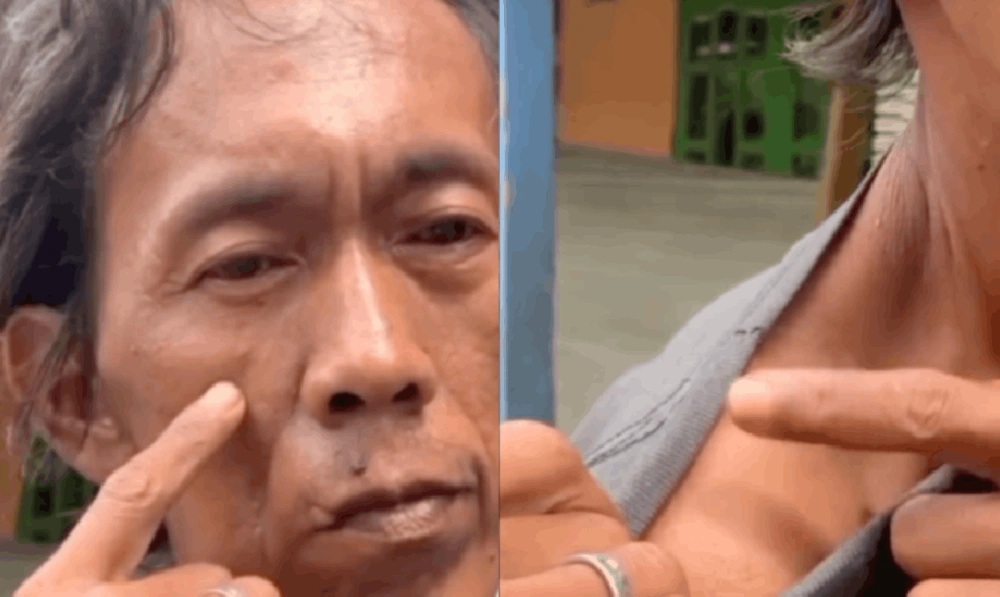 Suderajat Penjual Es Kue Jadul Mengaku Dianiaya Oknum Tni 1