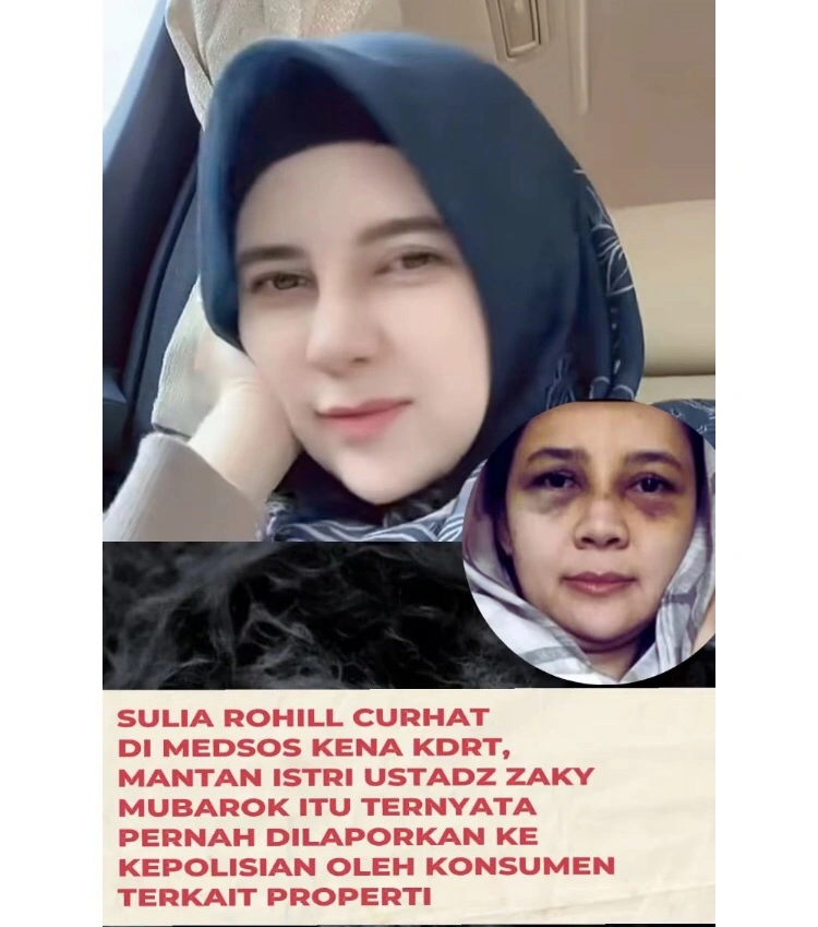 Suila Rohlil Mantan Istri Zaky Mubarok Yang Mengaku Mendapat Kdrt Dari Sang Ustadz [Sumber Instagram]