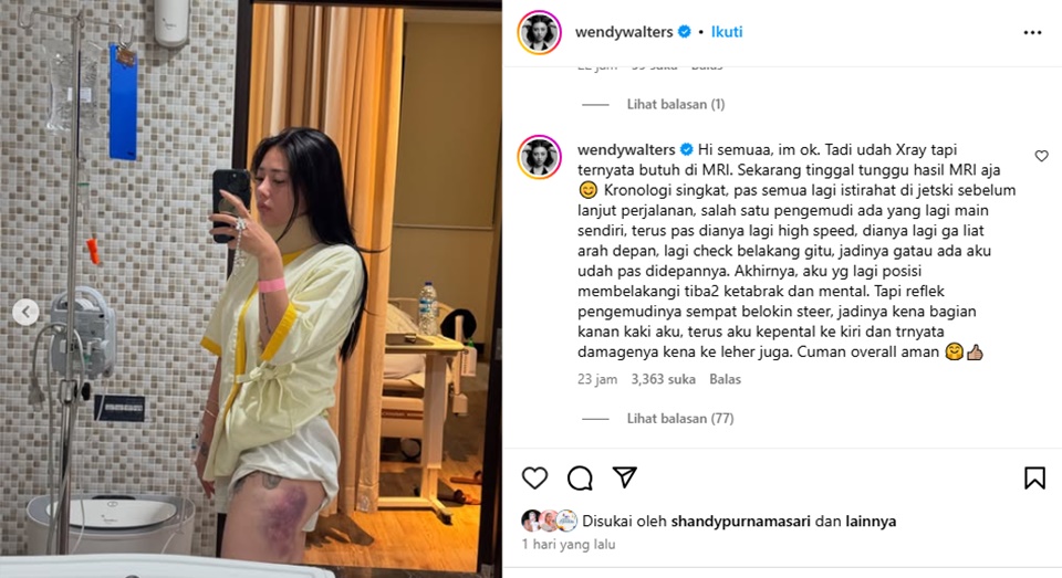 Wendy Walters Ungkap Kronologi Ditabrak Jetski [Instagram]