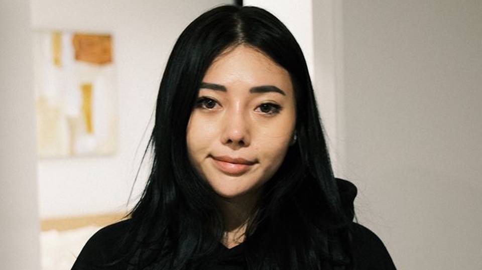 Wendy Walters Pilih Operasi Karena Hidungnya Miring, Kok Diam Ditanya Pernah Ditonjok Orang?