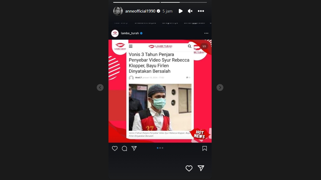 Putri Anne Seret Kasus Rebecca Klopper [Instagram]