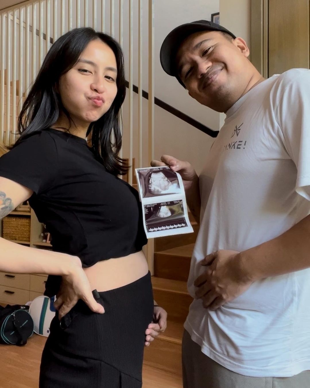 Istri Joshua Suherman Umumkan Kehamilan