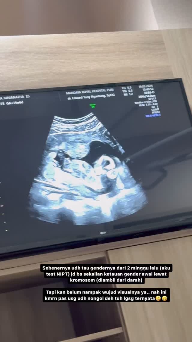 Terungkap Jenis Kelamin Anak Pertama Jonatan Christie dan Shanju