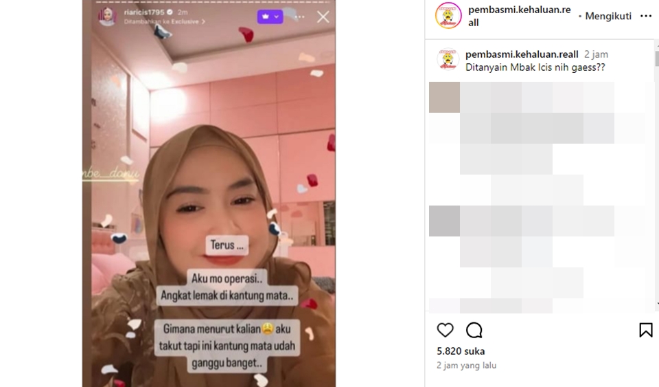 Ria Ricis Mau Operasi Kantung Mata