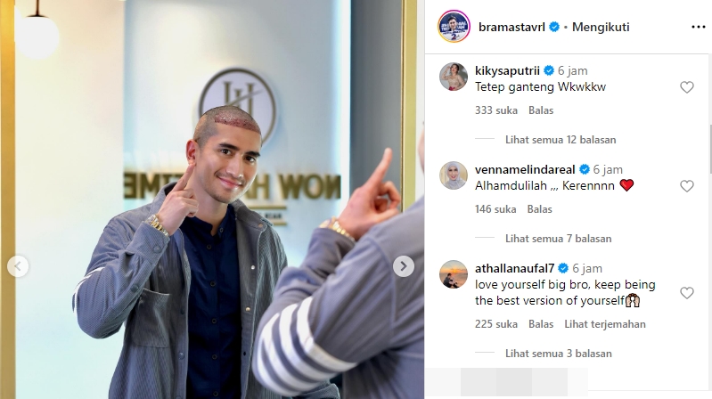 Tanggapan Venna Melinda Verrell Bramasta Transplantasi Rambut