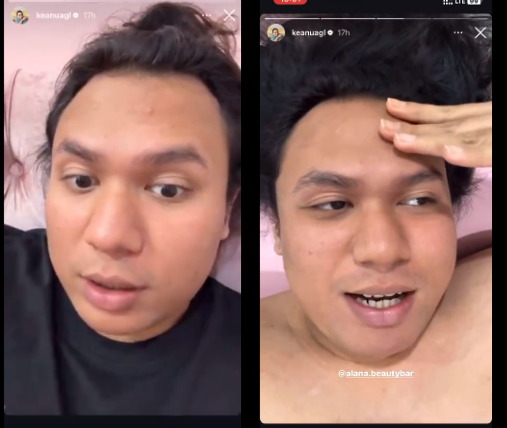 Keanu Angelo sedang perawatan [instagram]