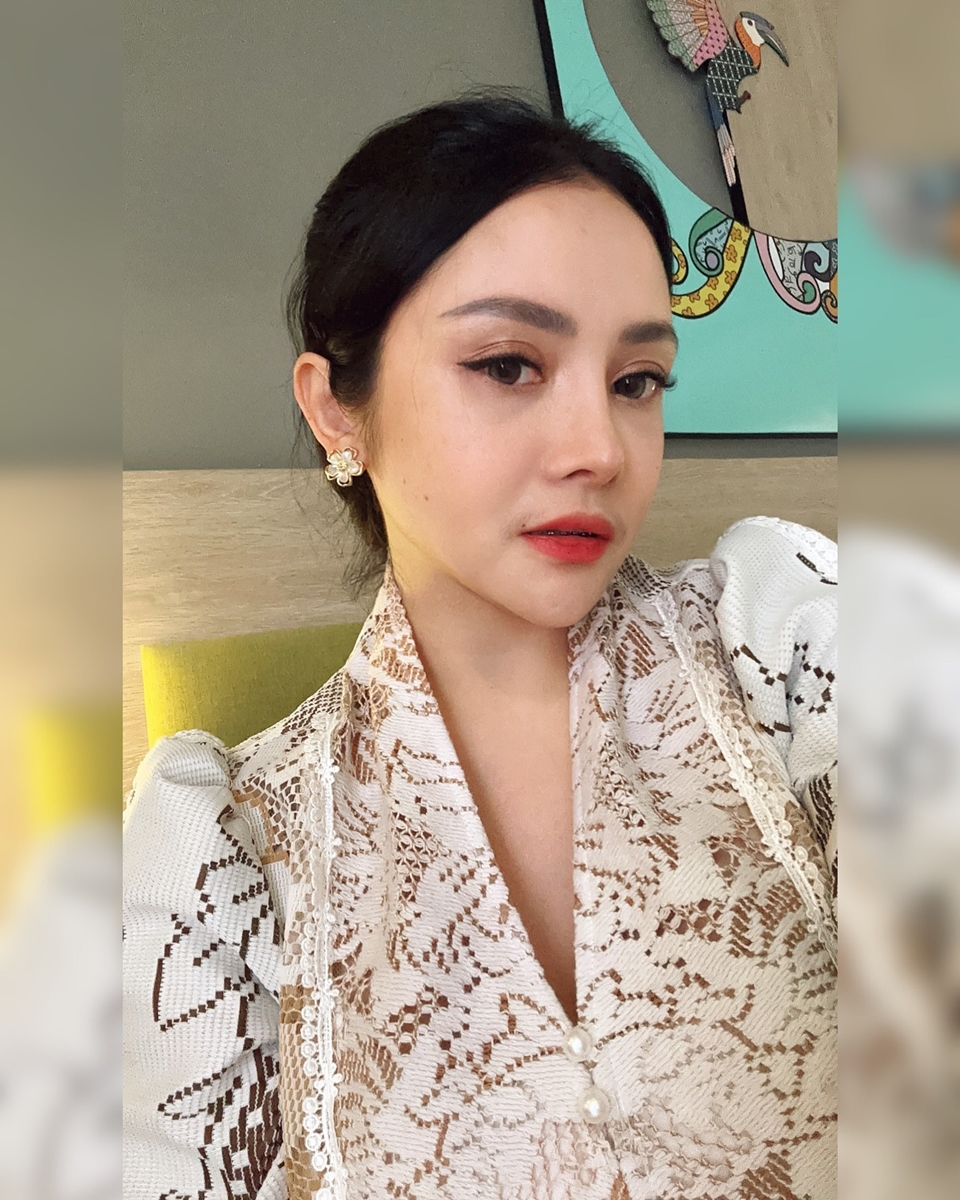 Mawar AFI Pasca Oplas [Instagram]