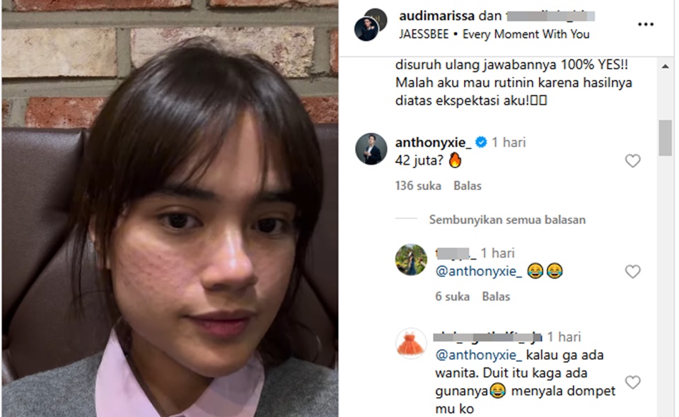 Anthony Xie Beri Respons 'Menyala' Saat Tahu Harga treatment Audi Marissa [Instagram]