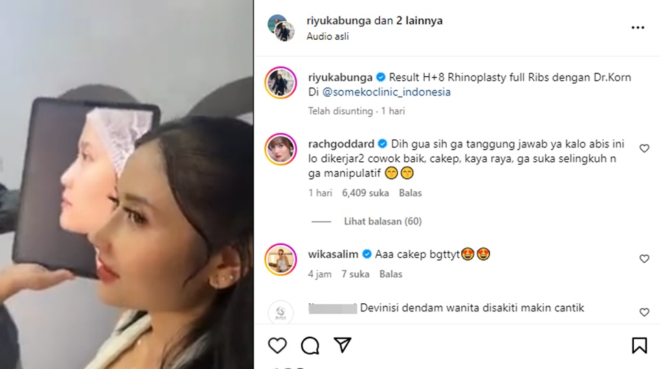 Riyuka Bunga Pasca Oplas Hidung Instagram